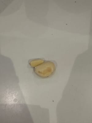蒜瓣、蒜末